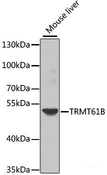 Immunohistochemistry of paraffin-embedded Rat lung using RSPO1 Polyclonal Antibody at dilution of  1:100 (40x lens).