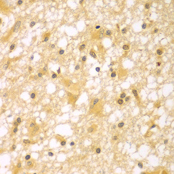Immunohistochemistry of paraffin-embedded Human prostate using MCCC2 Polyclonal Antibody at dilution of  1:100 (40x lens).