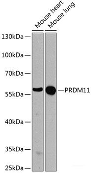 Immunofluorescence analysis of C6 cells using SNX15 Polyclonal Antibody at dilution of  1:100. Blue: DAPI for nuclear staining.