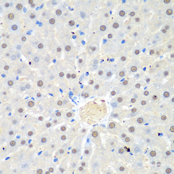 Immunohistochemistry of paraffin-embedded Rat liver using HIRIP3 Polyclonal Antibody at dilution of  1:100 (40x lens).