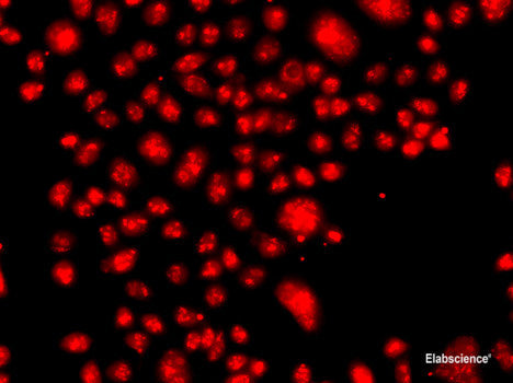 Immunohistochemistry of paraffin-embedded Mouse lung using FBXW11 Polyclonal Antibody at dilution of  1:100 (40x lens).