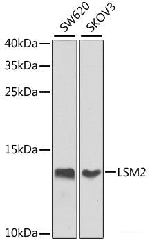 Immunohistochemistry of paraffin-embedded Human liver damage using TTLL12 Polyclonal Antibody at dilution of  1:100 (40x lens).
