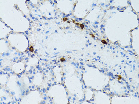 Immunohistochemistry of paraffin-embedded Human lung using C1QC Polyclonal Antibody at dilution of  1:100 (40x lens).
