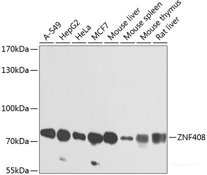 Immunohistochemistry of paraffin-embedded Human lung using COL6A1 Polyclonal Antibody at dilution of  1:100 (40x lens).