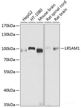 Western blot analysis of extracts of various cell lines using Phospho-MAP2K1（S217）/MAP2K2（S221） Polyclonal Antibody.
