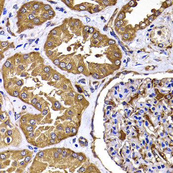 Immunohistochemistry of paraffin-embedded Human stomach using PIP4K2B Polyclonal Antibody at dilution of  1:100 (40x lens).
