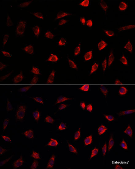 Immunohistochemistry of paraffin-embedded Rat kidney using RPS6KA3 Polyclonal Antibody at dilution of  1:100 (40x lens).