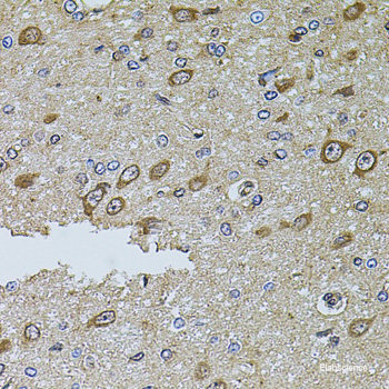 Immunofluorescence analysis of C6 cells using GTF3C4 Polyclonal Antibody at dilution of  1:100 (40x lens). Blue: DAPI for nuclear staining.