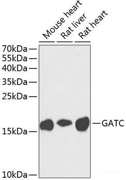 Immunohistochemistry of paraffin-embedded Human prostate using PLA2G7 Polyclonal Antibody at dilution of  1:100 (40x lens).