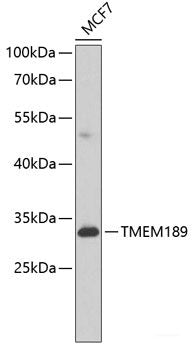 Immunofluorescence analysis of C6 cells using TRPV1 Polyclonal Antibody at dilution of  1:100. Blue: DAPI for nuclear staining.