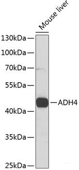 Immunohistochemistry of paraffin-embedded Rat testis using MME Polyclonal Antibody at dilution of  1:100 (40x lens).