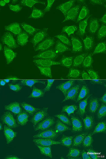 Immunohistochemistry of paraffin-embedded Human esophagus using CNOT8 Polyclonal Antibody at dilution of  1:100 (40x lens).