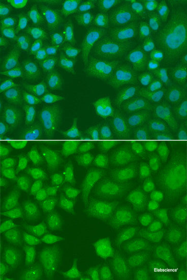 Immunohistochemistry of paraffin-embedded Human kidney using ARNT2 Polyclonal Antibody at dilution of  1:100 (40x lens).