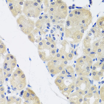 Immunohistochemistry of paraffin-embedded Human prostate using CYP46A1 Polyclonal Antibody at dilution of  1:100 (40x lens).