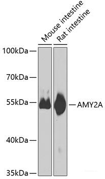 Immunohistochemistry of paraffin-embedded Human colon using CCDC92 Polyclonal Antibody at dilution of  1:100 (40x lens).