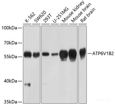 Immunohistochemistry of paraffin-embedded Rat brain using SAP18 Polyclonal Antibody at dilution of  1:100 (40x lens).