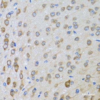 Immunohistochemistry of paraffin-embedded Human breast using SEPHS1 Polyclonal Antibody at dilution of  1:100 (40x lens).
