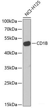Immunohistochemistry of paraffin-embedded Human liver damage using RBP2 Polyclonal Antibody at dilution of  1:100 (40x lens).