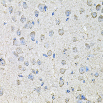 Immunohistochemistry of paraffin-embedded Human liver damage using EIF3M Polyclonal Antibody at dilution of  1:100 (40x lens).