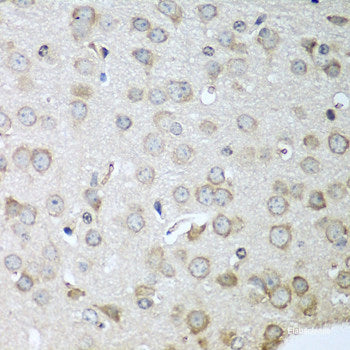 Immunohistochemistry of paraffin-embedded Mouse stomach using AP1M2 Polyclonal Antibody at dilution of  1:100 (40x lens).