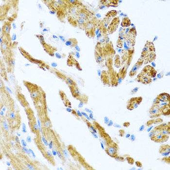 Immunofluorescence analysis of U2OS cells using Phospho-MAX(S11) Polyclonal Antibody