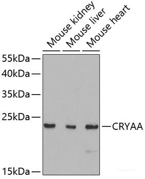 Immunofluorescence analysis of C6 cells using RPL17 Polyclonal Antibody at dilution of  1:100. Blue: DAPI for nuclear staining.