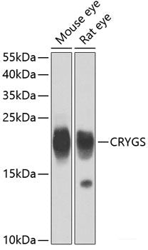 Immunofluorescence analysis of HeLa cells using CPS1 Polyclonal Antibody at dilution of  1:100 (40x lens). Blue: DAPI for nuclear staining.