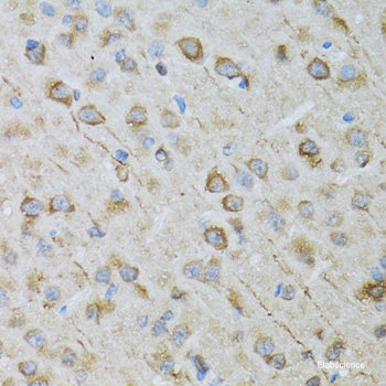 Immunohistochemistry of paraffin-embedded Mouse lung using TOMM34 Polyclonal Antibody at dilution of  1:100 (40x lens).