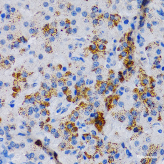 Immunohistochemistry of paraffin-embedded Rat spleen using CD27 Polyclonal Antibody at dilution of  1:100 (40x lens).