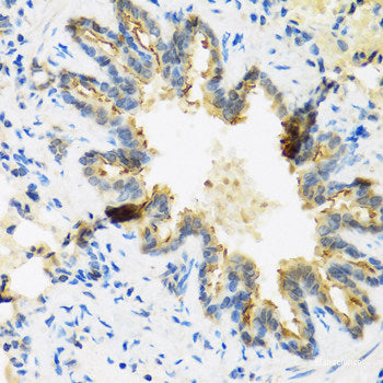 Immunofluorescence analysis of HeLa cells using MAPK1/MAPK3 Polyclonal Antibody at dilution of  1:100 (40x lens). Blue: DAPI for nuclear staining.