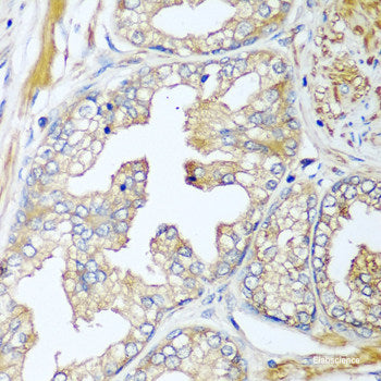 Immunohistochemistry of paraffin-embedded Human esophagus using KPNA3 Polyclonal Antibody at dilution of  1:100 (40x lens).