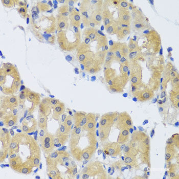 Immunohistochemistry of paraffin-embedded Human esophagus using PHB2 Polyclonal Antibody at dilution of  1:100 (40x lens).