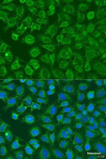 Immunofluorescence analysis of HeLa cells using MonoMethyl-NONO-R357/R365 Polyclonal Antibody at dilution of  1:100 (40x lens). Blue: DAPI for nuclear staining.