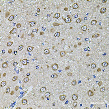 Immunohistochemistry of paraffin-embedded Human prostate using NLGN4Y Polyclonal Antibody at dilution of  1:100 (40x lens).