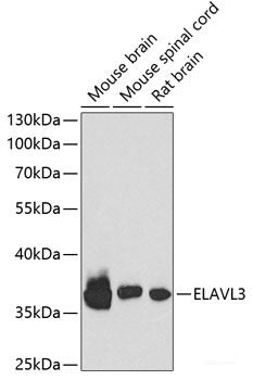 Immunofluorescence analysis of U2OS cells using FAP Polyclonal Antibody at dilution of  1:100. Blue: DAPI for nuclear staining.