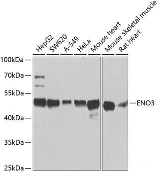 Western blot analysis of extracts of various cell lines using KIFAP3 Polyclonal Antibody at dilution of 1:1000.