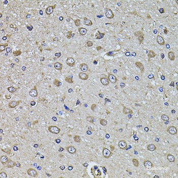 Immunohistochemistry of paraffin-embedded Rat brain using AIFM3 Polyclonal Antibody at dilution of  1:100 (40x lens).