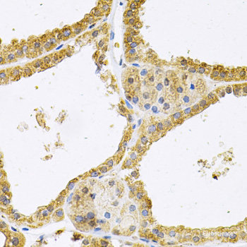 Immunohistochemistry of paraffin-embedded Human prostate using LEP Polyclonal Antibody at dilution of  1:100 (40x lens).
