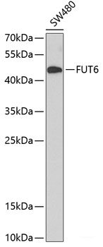 Immunofluorescence analysis of U-2 OS cells using ADNP Polyclonal Antibody at dilution of  1:100 (40x lens). Blue: DAPI for nuclear staining.