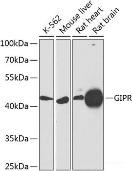 Immunohistochemistry of paraffin-embedded Rat lung using Phospho-MYC(S62) Polyclonal Antibody at dilution of  1:100 (40x lens).