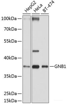 Immunohistochemistry of paraffin-embedded Rat spinal cord using ADRBK2 Polyclonal Antibody at dilution of  1:100 (40x lens).
