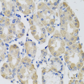 Immunohistochemistry of paraffin-embedded Rat brain using TTR Polyclonal Antibody at dilution of  1:100 (40x lens).