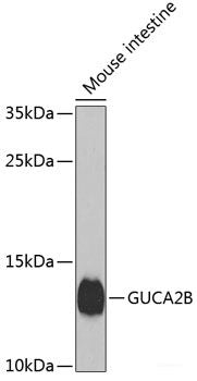 Immunohistochemistry of paraffin-embedded Human prostate using HERC3 Polyclonal Antibody at dilution of  1:100 (40x lens).