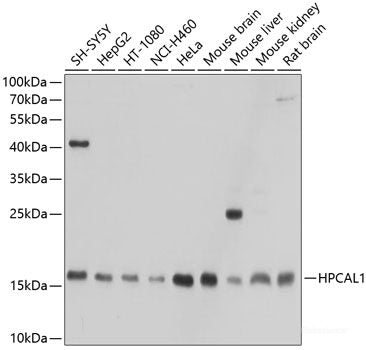 Immunofluorescence analysis of HeLa cells using ADAM10 Polyclonal Antibody at dilution of  1:100. Blue: DAPI for nuclear staining.
