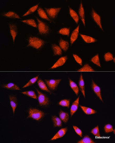 Immunofluorescence analysis of U2OS cells using ARF3 Polyclonal Antibody at dilution of  1:100. Blue: DAPI for nuclear staining.