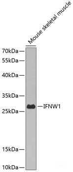Immunohistochemistry of paraffin-embedded Rat liver using RNF5 Polyclonal Antibody at dilution of  1:100 (40x lens).