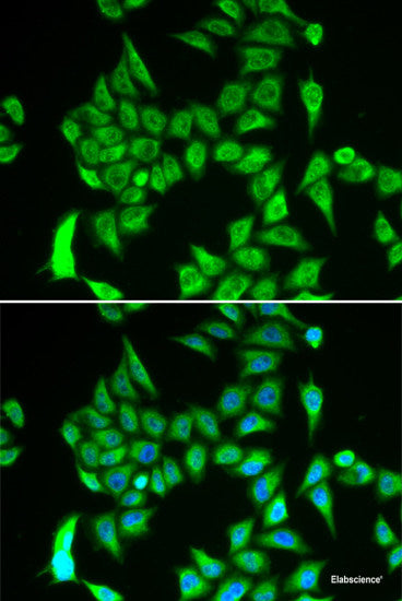 Immunohistochemistry of paraffin-embedded Mouse skin using CALU Polyclonal Antibody at dilution of  1:100 (40x lens).