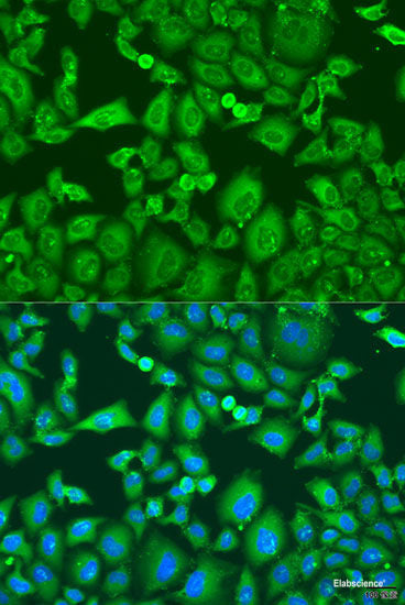 Immunofluorescence analysis of U2OS cells using ENTPD5 Polyclonal Antibody at dilution of  1:100. Blue: DAPI for nuclear staining.