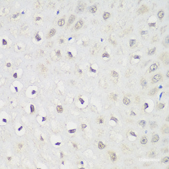 Immunohistochemistry of paraffin-embedded Rat brain using MTIF3 Polyclonal Antibody at dilution of  1:100 (40x lens).
