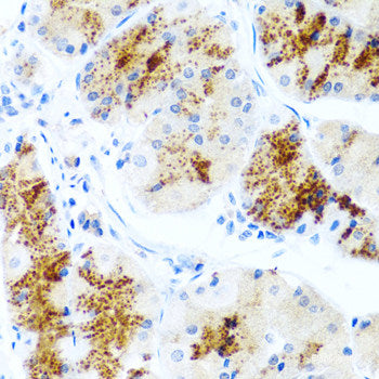 Immunohistochemistry of paraffin-embedded Rat brain using RPN2 Polyclonal Antibody at dilution of  1:100 (40x lens).